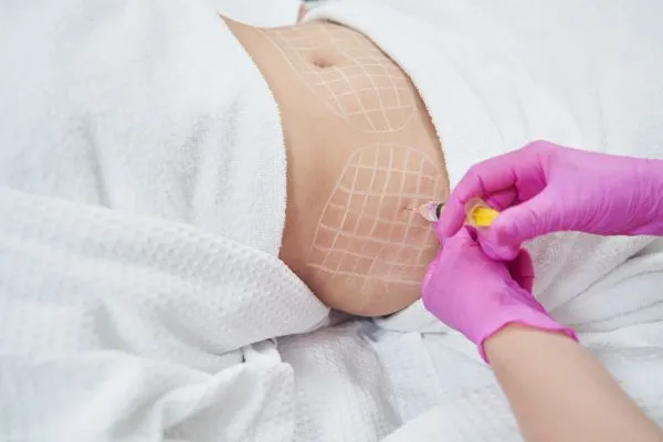 image of fat dissolving injections on love handles to help combat weight gain Ogden
