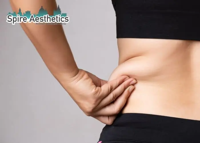 Image of woman pinching fat on their hips Ogden. Fat Freezing treatment