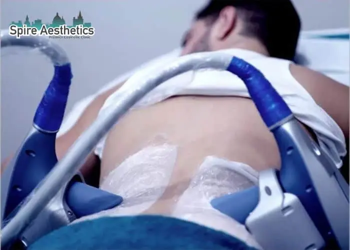 Man having fat freezing treatment done on love handles before a competitions Ogden to create a sculpted look.